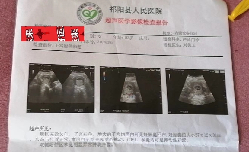 北京幸福好孕试管婴儿
